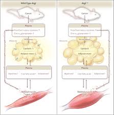 Image result for Cachexia in Cancer