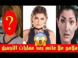 حيث يمكنك إضافة فواصل إعلانية تزيد من عدد المشاهدات والنقرات، ولكن لا تضع الكثير من الفواصل الإعلانية، فهذا يمكن أن يؤثر سلبا على قناتك ويؤدي إلى إلغاء الاشتراك بها من قبل العديد من الأشخاص. Ù„Ù† ØªØµØ¯Ù‚Ùˆ ÙƒÙŠÙ ØªØºÙŠØ±Øª Ù…Ù„Ø§Ù…Ø­ Ø¹Ù„Ø§ ØºØ§Ù†Ù… Ø¨Ø¹Ø¯ Ø¹Ù…Ù„ÙŠØ§Øª Ø§Ù„ØªØ¬Ù…ÙŠÙ„ Ø¹Ù„Ø§ ØºØ§Ù†Ù… Ù‚Ø¨Ù„ ÙˆØ¨Ø¹Ø¯ Ø¹Ù…Ù„ÙŠØ§Øª Ø§Ù„ØªØ¬Ù…ÙŠÙ„ Animated Gif Animation Videos
