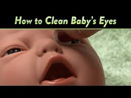 How To Clean Baby S Eyes And Clogged Tear Ducts Cloudmom Blocked Tear Duct Baby Baby Eyes Blocked Tear Duct