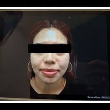 TIFFANY MCCORMACK, MD, FACS