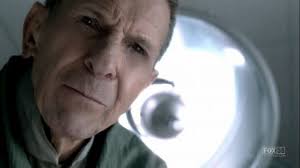 Fringemanía: 10.2. "Grey matters" o como Walter descubre que le extirparon  partes del cerebro