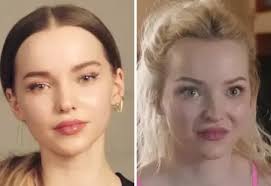 Dove Cameron Plastic Surgery: Did It Happen?