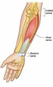 Pin On Handtherapie