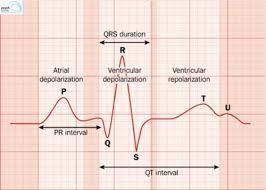 Qtc Prolongation And Psychotropics Clinical Evaluation And Management