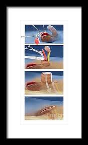 #digitalart #artwork #cutegirl #2020artsummary #artsummary #illustration #art pic.twitter.com/dmarwy9sef. Gender Dysphoria Art Fine Art America