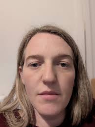 I thought my under eye bags were the issue but people have been saying the  upper eyes are the issue. Has anyone had this done in the UK? It's so  expensive :(