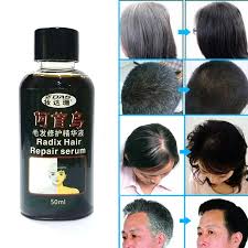 The top countries of suppliers are china, south korea, and vietnam, from. Traditional Chinese Medicine Cure White Hair Turn Gray Black Liquid Juvenile Loss Care Oil Serum Treatment Conditioners 50ml 3 Hair Medicine Oil Hair Lossmedicine Hair Loss Aliexpress