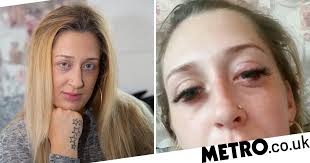 Woman feared she would never see baby's face after lashes 'blinded her'