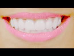 Have an oral surgeon extract them all and arrange them on the table in straight lines. Diy Get Straight Teeth Free Fast At Home è‡ªå®¶è£½ãƒ–ãƒ¬ãƒ¼ã‚¹ Youtube