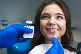 Cosmetic Porcelain Veneers Dublin CA