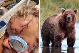 They are very strong swimmers, and their large front paws, which they use to paddle, are slightly webbed. Alaska Man Survives Horrific Bear Attack While On The Job