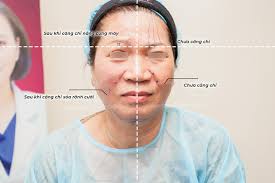Phòng khám da liễu thẩm mỹ Pensilia