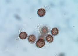 Image result for Scleroderma polyrhizon