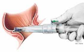 How To Integrate Crh O Regan System Into Your Practice