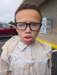 What is the best treatment for a bee sting