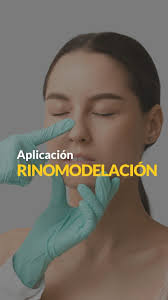 🌟 ¡Transforma tu perfil con rinomodelación por el Dr. Gustavo Ulloa! 🌟  Resultados naturales y sin cirugía. Disponible en Arica., 📍 Calle Chiloé  659, Arica, 📞 Agenda tu hora ahora: (058) 231 59 75