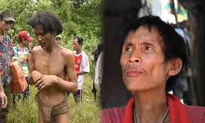 Người đàn ông sống trong rừng 40 năm, sau khi được 'giải cứu' 8 năm giờ  chung sống với căn bệnh ung thư, mắt đau đáu nhớ rừng