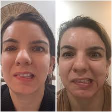 person recovering from illness regains confidence