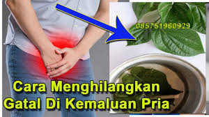 Selain obat gatal tradisional yang diminum, ini bahan alami ampuh yang bisa hilangkan gatal hanya dalam waktu 5 menit. Info Penting Cara Menghilangkan Gatal Di Kemaluan Pria Secara Alami Sehat Cara Mudah Bulan November 2019 Jazz Indonesia