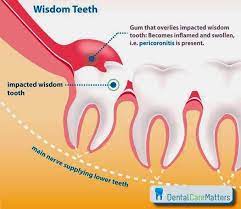 Pin On Dental