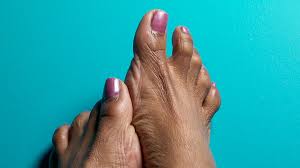 Image result for diabetic toes