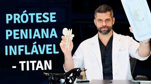 Conheca Todas As Informacoes Da Protese Peniana Inflavel Titan Dr Marco Tulio Cavalcanti Youtube