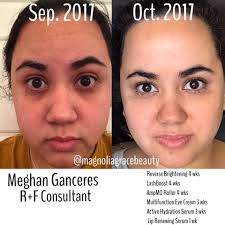 Soooo.... I did a thanggg! B▪️O▪️T▪️O▪️X. Big shout out to my girl 💕Olivia  Rodgers 💕at Blush Aesthetics! If you have every considered it..... go see  my girlfriend! It's quick..... nearly painless.... and