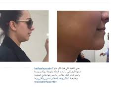 نوال الزغبي أطلت بعفوية تامة على متابعيها عبر انستغرام حيث شاركتهم بصورة لها متخلية فيها عن مساحيق التجميل، فبدت بملامحها الناعمة والطبيعية بدون مكياج، فأشاد الجمهور بخطوتها خاصة وأنهم قارنوا صورها قبل وبعد المكياج. Ø¨Ø§Ù„ØµÙˆØ± Ù‡ÙŠÙØ§Ø¡ Ø­Ø³ÙŠÙ† ØªØ¬Ø±ÙŠ Ø¹Ù…Ù„ÙŠØªÙŠ ØªØ¬Ù…ÙŠÙ„ ÙÙŠ ÙˆØ¬Ù‡Ù‡Ø§ Ù…Ø¬Ù„Ø© Ù‡ÙŠ