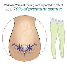 Pin On Pregnancy Care