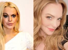 Lindsay Lohan asombró a todos con su nuevo rostro