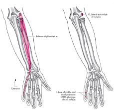 Extensor digiti minimi tendon transfer to prevent recurrent ulnar drift. Neurokinetic Therapy Pain In The Elbow Like Pain In The Knee Is Usually The Result Of Some Dysfunction In The Shoulder Or Wrist Client Presented With Tennis Elbow Or Lateral Epicondylitis