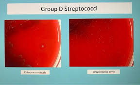 Image result for Group D Streptococcus