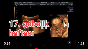 17 haftalik gebelik