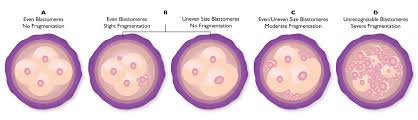 Embryo Grading Blastocyst Implantation Blastocyst Grading