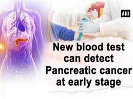 But there is not one specific blood test to find or diagnose these tumors. New Blood Test Can Detect Pancreatic Cancer At Early Stage Ani News Youtube