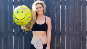 Crohn S Disease Australian Researchers Make Breakthrough In The Treatment Herald Sun