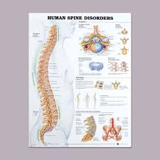 Anatomical Chart For Spine Disorders