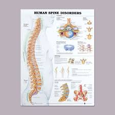 anatomical chart for spine disorders