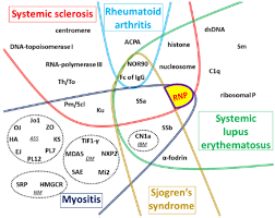Image result for Connective Tissue Disorder