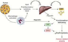 Frontiers Pathogenesis And Treatment Options Of Cancer Related Anemia Perspective For A Targeted Mechanism Based Approach Physiology