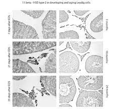 Hydrohysteroid Dehydrogenases Biological Role And Clinical Importance Review Intechopen