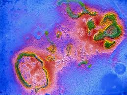 Wereldwijd is het echter de tweede doodsoorzaak bij jonge kinderen. False Col Tem Of Respiratory Syncytial Rs Virus Stock Image M050 0070 Science Photo Library