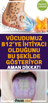 Vucudumuz B12 Ye Ihtiyaci Oldugunu Bu Sekilde Gosteriyor Health