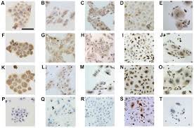 Cell lines of a finite life are usually diploid and maintain some degree of differentiation. Establishment And Characterization Of Cell Lines Derived From Complete Hydatidiform Mole
