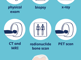 Pain in the affected bone is the most common sign of bone cancer. Bone Cancer Overview And More