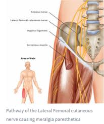 You can feel these muscles contract by placing your hand just to the outside of the tibia and. Meralgia Paresthetica Treatment