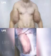 Терешин закачивал в руки-базуки вазелин