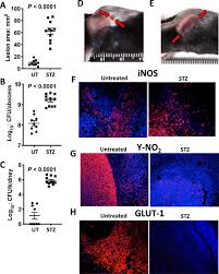 Lack of nutritional immunity in diabetic skin infections promotes  Staphylococcus aureus virulence
