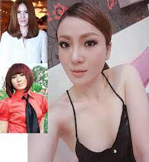 Yến Nhi May Trắng Giờ Ra Sao Sau 6 Năm Bị Che Sửa Mặt Hỏng