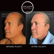 Jack Zamora Md Cosmetic Surgery and Aesthetics, спа-салон, штат Колорадо,  округ Арапахо, Денвер — Яндекс Карты